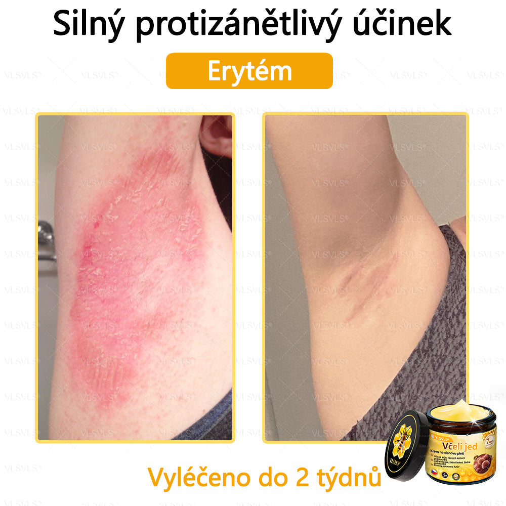 ✅VLSVLS™ Obnovující krém se včelím jedem🐝🐝