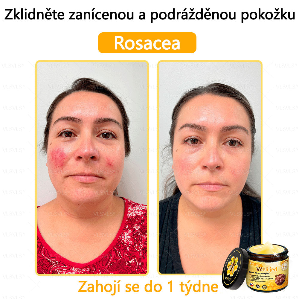 ✅VLSVLS™ Obnovující krém se včelím jedem🐝🐝
