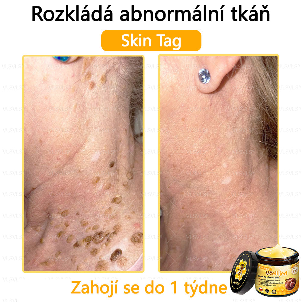 ✅VLSVLS™ Obnovující krém se včelím jedem🐝🐝