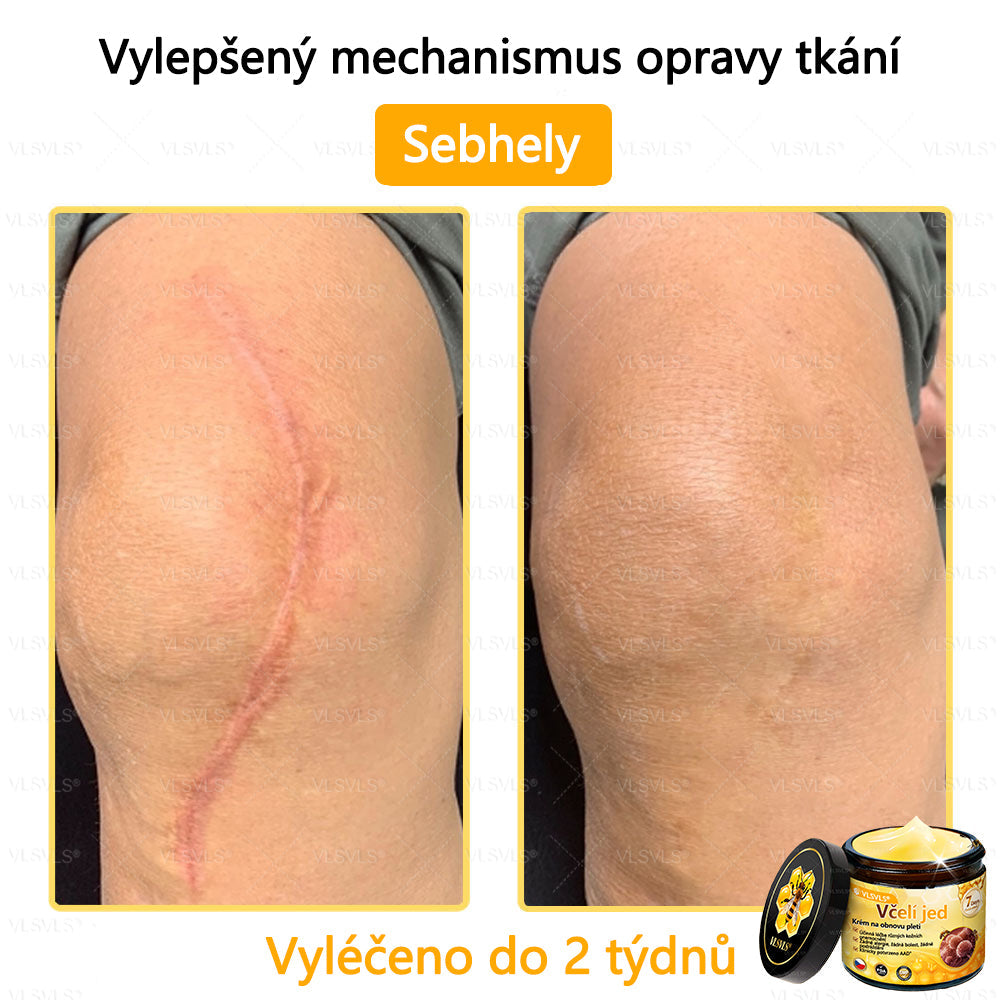 ✅VLSVLS™ Obnovující krém se včelím jedem🐝🐝