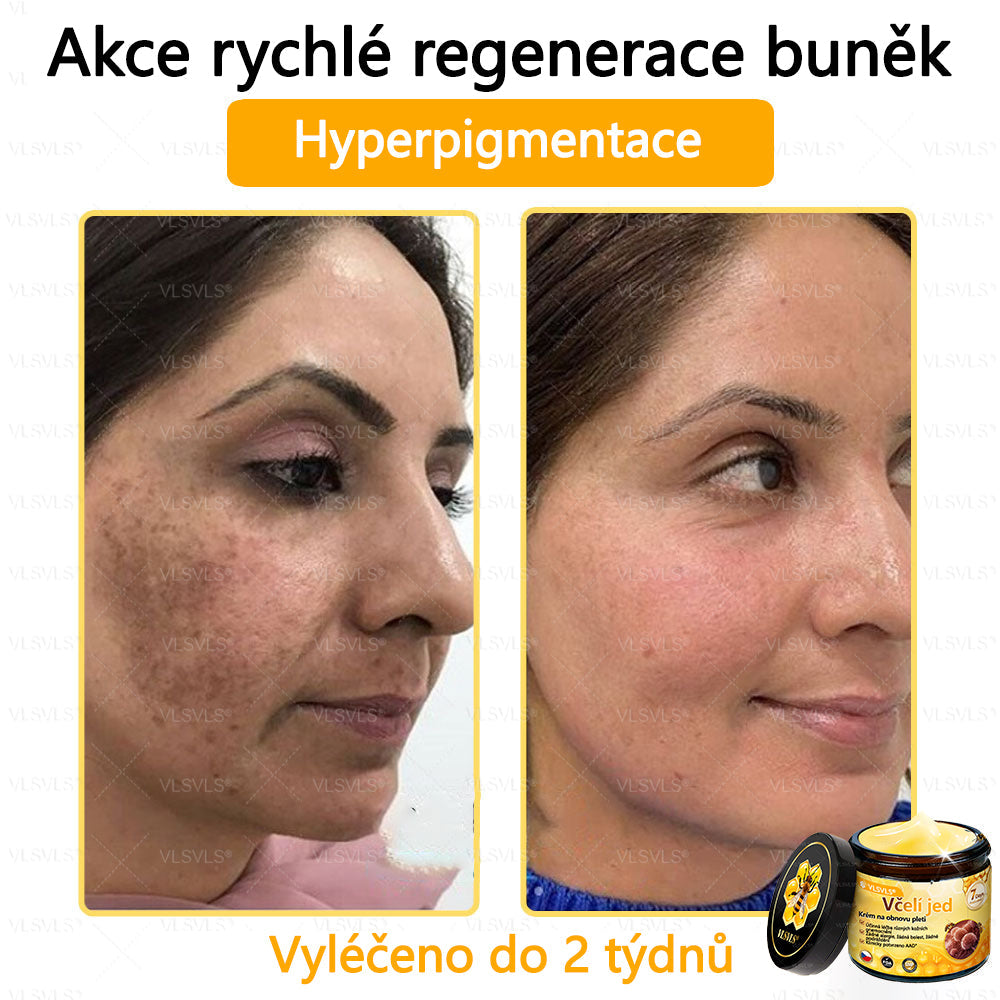 ✅VLSVLS™ Obnovující krém se včelím jedem🐝🐝