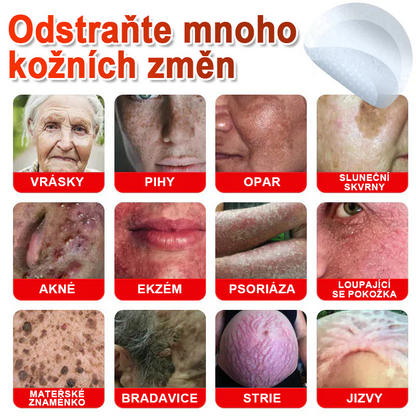 TLOPA® Mikrovpichová botanická náplast na odstranění kožních výrůstků 🇨🇿 Vyrobeno v Česká republika🇨🇿