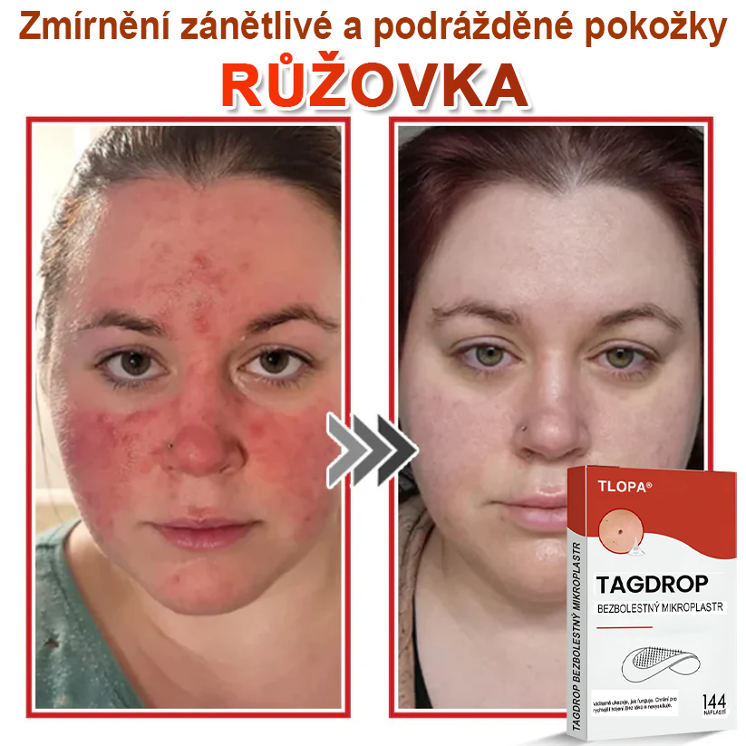 TLOPA® Mikrovpichová botanická náplast na odstranění kožních výrůstků 🇨🇿 Vyrobeno v Česká republika🇨🇿