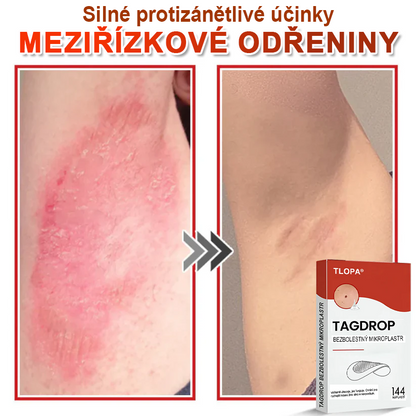 TLOPA® Mikrovpichová botanická náplast na odstranění kožních výrůstků 🇨🇿 Vyrobeno v Česká republika🇨🇿