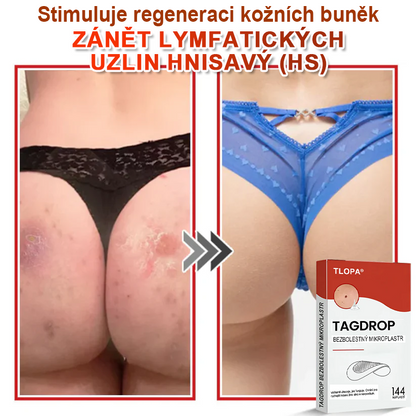 TLOPA® Mikrovpichová botanická náplast na odstranění kožních výrůstků 🇨🇿 Vyrobeno v Česká republika🇨🇿