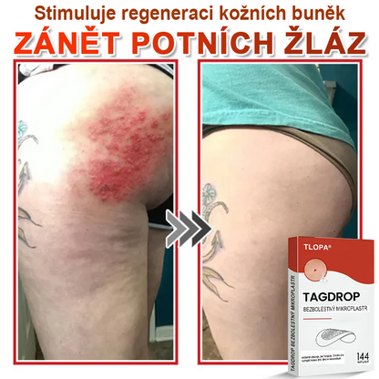 TLOPA® Mikrovpichová botanická náplast na odstranění kožních výrůstků 🇨🇿 Vyrobeno v Česká republika🇨🇿
