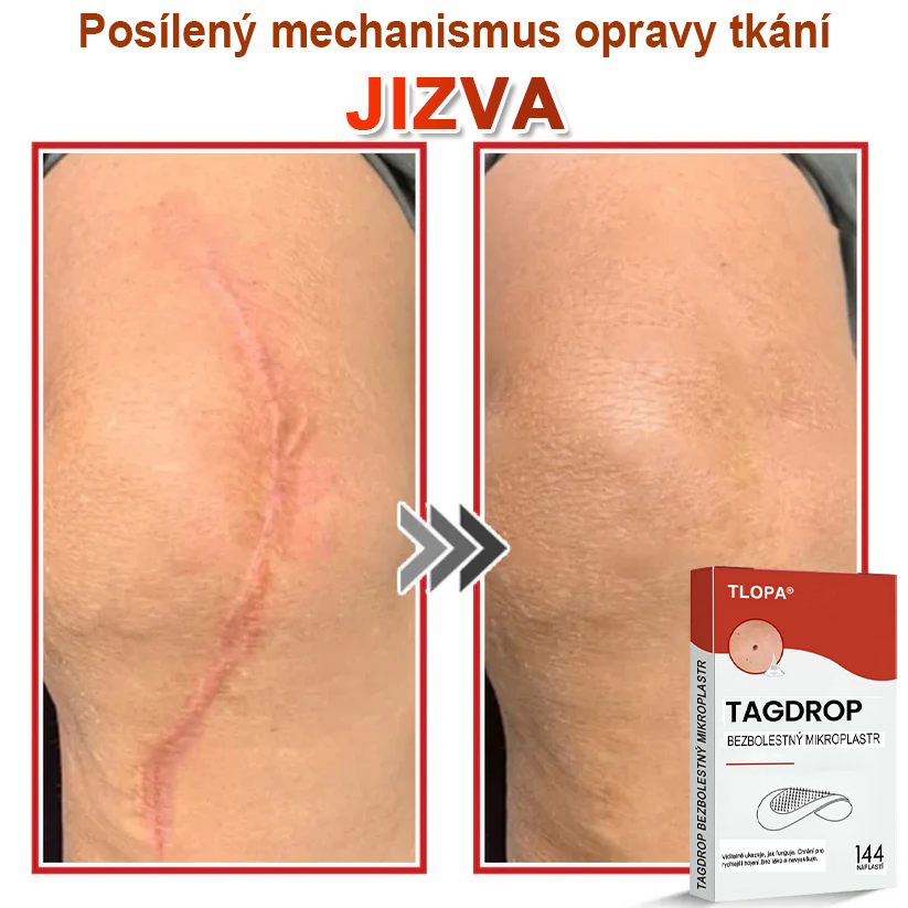 TLOPA® Mikrovpichová botanická náplast na odstranění kožních výrůstků 🇨🇿 Vyrobeno v Česká republika🇨🇿