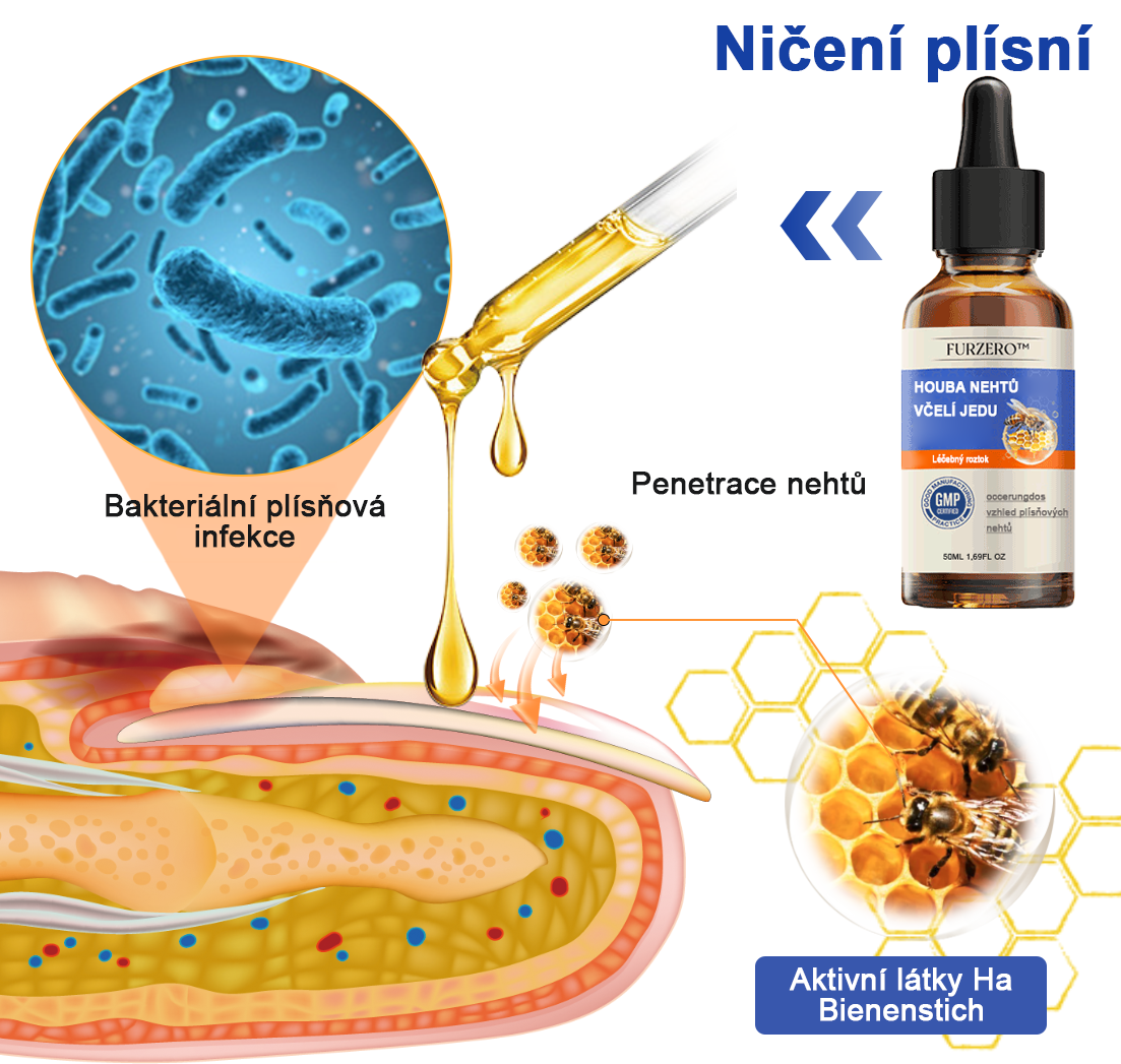 🐝🐝Furzero™ Včelí jed na plíseň nehtů: kompletní řešení plísně nehtů 🌟👣👣
