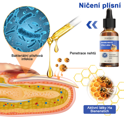 🐝🐝Furzero™ Včelí jed na plíseň nehtů: kompletní řešení plísně nehtů 🌟👣👣