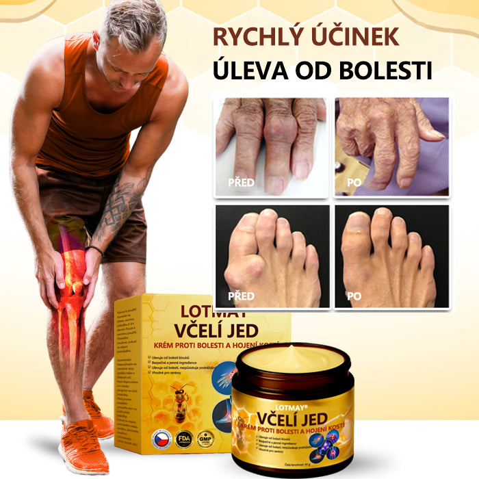 LOTMAY® Krém na hojení kostí proti bolesti se včelím jedem