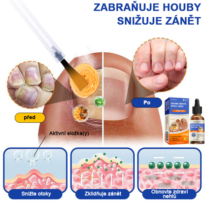 🐝🐝Furzero™ Včelí jed na plíseň nehtů: kompletní řešení plísně nehtů 🌟👣👣