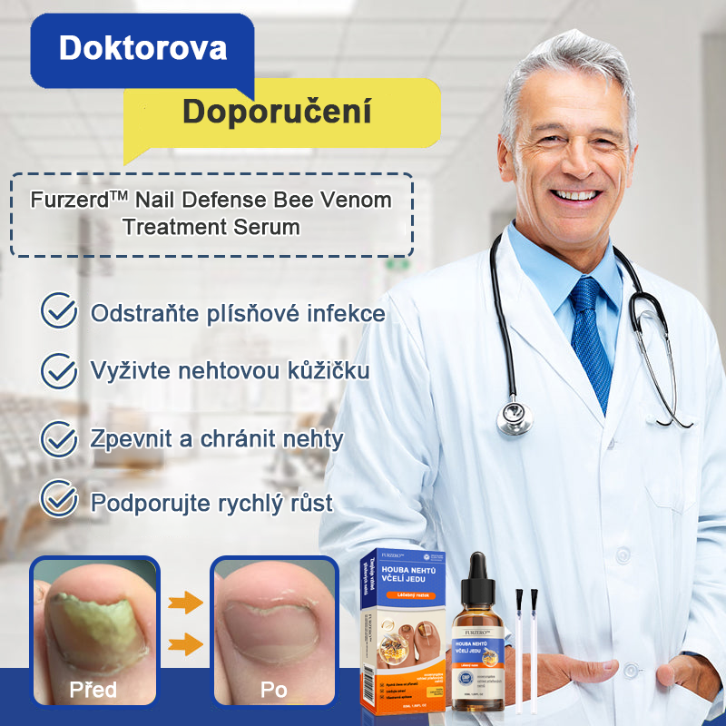 🐝🐝Furzero™ Včelí jed na plíseň nehtů: kompletní řešení plísně nehtů 🌟👣👣